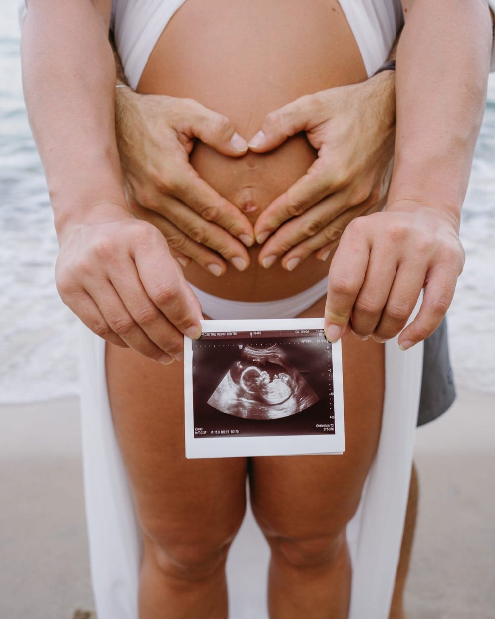 Couple's hands making a heart on the bump, with the scan · Objectiu Fotògrafs, Reus
